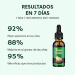 ACEITE EN GOTAS PARA HONGOS - UÑAS DE PIES Y MANOS + ENVIO GRATIS